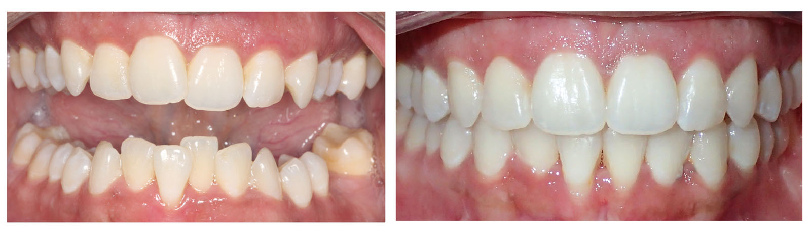 West Chicago Smiles | Digital Impressions, Oral Exams and Emergency Treatment