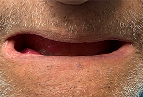 West Chicago Smiles | Cosmetic Dentistry, Pediatric Dentistry and Root Canals