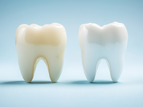 West Chicago Smiles | Pediatric Dentistry, Sports Mouthguards and Preventative Program