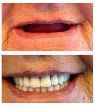 West Chicago Smiles | Digital Impressions, Veneers and Pediatric Dentistry