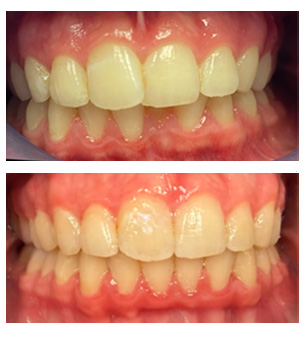 West Chicago Smiles | CBCT, Implant Dentistry and Dental Fillings